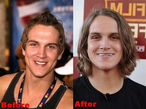 The promotion came barely one week after rife insinuations that the Chief of. . Jason mewes teeth